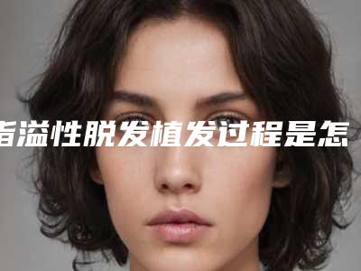 脂溢性脱发植发过程是怎样的有没有副作用